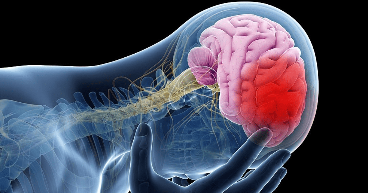 ¿Cuál es el tipo de sangre con mayor riesgo de accidentes cerebrovasculares?