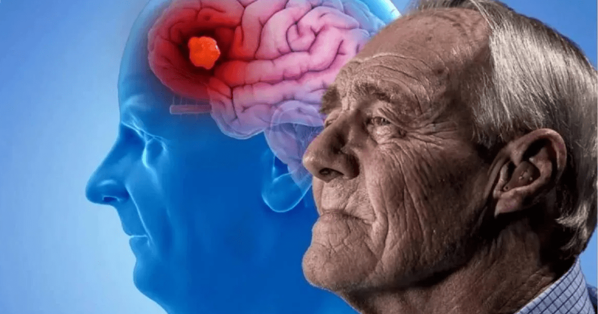 ¿Cuál es el primer recuerdo que se pierde en la etapa inicial del Alzheimer?