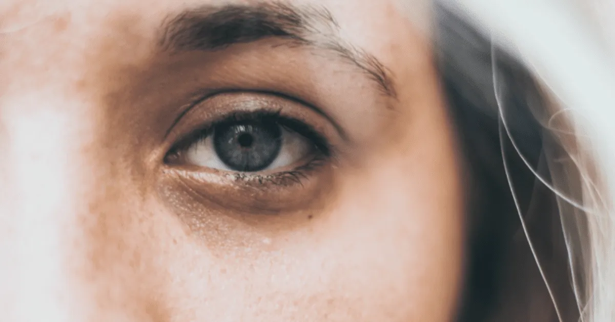 La poderosa planta con colágeno que borra las bolsas de los ojos para siempre, según expertos