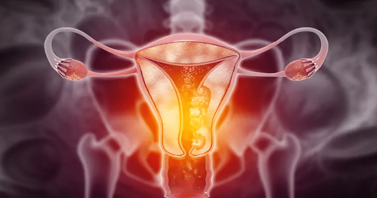 ¿Conoces los 3 síntomas clave del cáncer de cuello uterino que no debes ignorar?