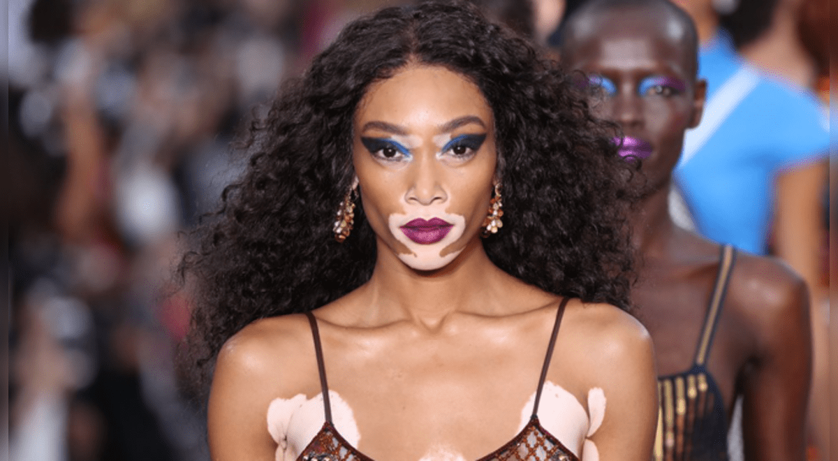 Winnie Harlow Modelo Con Vitíligo Festeja Su Primera Portada De Vogue