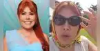 Magaly Medina RESPONDE sin pelos en la lengua sobre su cirugía: “Mi cara es mi mayor inversión”