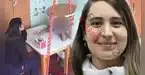 Bachiller en psicología niega haber agredido a menor con autismo y afirma que actuó en defensa propia Bachiller en psicología niega haber agredido a menor con autismo y afirma que actuó en defensa propia