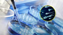 Donante de esperma heredada mutación genética y causa una decena de casos de cáncer infantil