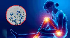 La silenciosa amenaza podría cambiar la salud global: hongos resistentes avanzan sin control