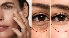 Contorno de ojos: así aplican la crema los expertos para reducir ojeras y bolsas de manera efectiva