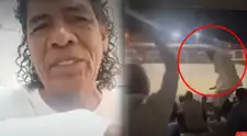Cómico Cachay requiere cirugía urgente de 25 mil soles tras ataque y adopta medida contundente: "Este asunto no queda así"