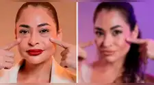 "Gracias por devolverme la juventud": Melanie Martínez impacta al mostrar su nuevo rostro tras cirugía estética