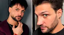 Nicola Porcella DEJA EN SHOCK a fans al lucir su NUEVA NARIZ tras su cuarta cirugía: "No es el resultado final"