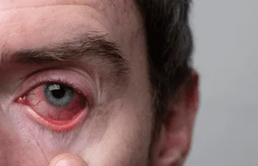 ¡No más vista cansada! Estas 3 vitaminas salvan tu salud visual, según expertos ¡No más vista cansada! Estas 3 vitaminas salvan tu salud visual, según expertos