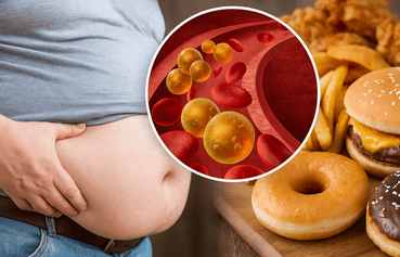 ¡Alerta en tu cuerpo! 3 señales claras de triglicéridos altos y cómo reducirlos ¡Alerta en tu cuerpo! 3 señales claras de triglicéridos altos y cómo reducirlos