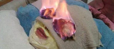 Un salón de belleza chino ofrece eliminar las arrugas con "fuego facial" Un salón de belleza chino ofrece eliminar las arrugas con "fuego facial"