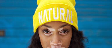 Winnie Harlow sufrió bullying desde sus 4 años de edad Bullying: Chantelle Brown- Young fue víctima en la escuela