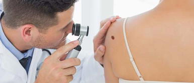 Foto: cloudfront.net Liga Contra el Cáncer iniciará campaña “Prevención365” para el despistaje de cáncer de piel