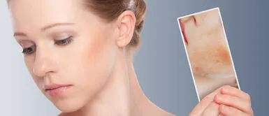 Conoce la prueba del parche para determinar la alergia a los cosméticos Conoce la prueba del parche para determinar la alergia a los cosméticos