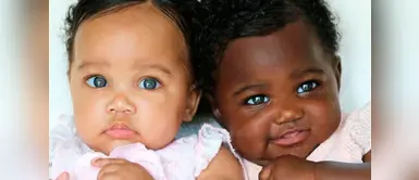 Estas gemelas nacieron con distinto color de piel, ¿cómo es posible esto? Estas gemelas nacieron con distinto color de piel, ¿cómo es posible esto?