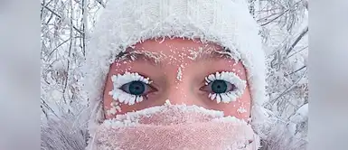 El frío extremo congela las lágrimas, la saliva, la barba, las pestañas y todo lo que no esté cubierto. El frío extremo congela las lágrimas, la saliva, la barba, las pestañas y todo lo que no esté cubierto.