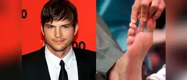 Aston Kutcher también tiene un problema en los pies. Dos de sus dedos están unidos por el tronco. Aston Kutcher también tiene un problema en los pies. Dos de sus dedos están unidos por el tronco.