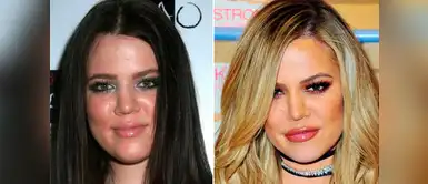 Khloe Kardashian recurrió al cirujano para disolverse los pomulos Khloe Kardashian recurrió al cirujano para disolverse los pomulos