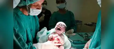 ¿La cesárea causa daños en los bebés? Conoce por qué debes descartarla ¿La cesárea causa daños en los bebés? Conoce por qué debes descartarla