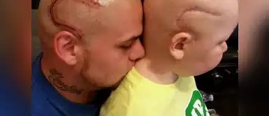 Falleció Gabe Marshall, el niño cuyo padre se tatuó la misma cicatriz en la cabeza Falleció Gabe Marshall, el niño cuyo padre se tatuó la misma cicatriz en la cabeza