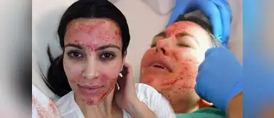 El "Vampiro facial" se popularizó luego que Kim lo realizara. ¿Por qué Kim Kardashian se arrepiente del “facial vampiro”?