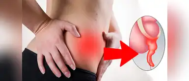 Presta atención a las alertas que emite tu cuerpo. Apendicitis: Estas son las señales para saber si estás en riesgo ¡Podrían salvar tu vida!