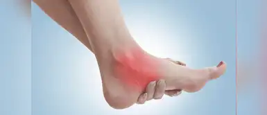 Razones por las que se te hinchan los pies ¿Por qué se te hinchan los pies?