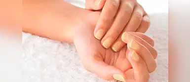 El color de tus uñas podrían decirte mucho sobre tu salud. ¡Atenta! ¿Tienes uñas amarillas o agrietadas? Tu salud podría estar en peligro