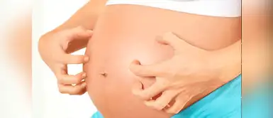 Con estos tips ya no tendrás tanta picazón durante tu embarazo. Cinco tips para aliviar la incómoda picazón durante el embarazo ¡Comprobado!