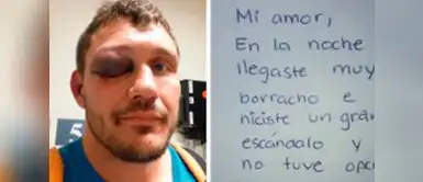 Este hombre jamás pensó que su esposa le escribiría una nota tan conmovedora. Hombre se despierta con el ojo morado y rompe en llanto al ver la nota de su esposa