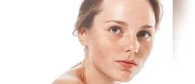 Esto es lo que no sabías acerca de las pecas en tu rostro. Seis curiosidades de las pecas que te harán entender que son hermosas