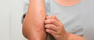 Estos son los síntomas que puedes sentir si tienes estrés en exceso. 16 formas en las que el estrés afecta a tu cuerpo y tú no lo notaste