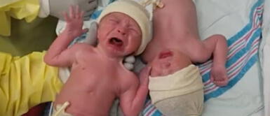 Facebook: Gemelos prematuros protagonizan tierno video que te conmoverá Facebook: Gemelos prematuros protagonizan tierno video que te conmoverá