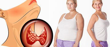 Tres consejos que te ayudarán a bajar de peso si tienes hipotiroidismo Tres consejos que te ayudarán a bajar de peso si tienes hipotiroidismo