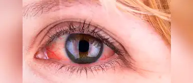 Dinos el color de tus ojos y te revelaremos qué enfermedad tienes Dinos el color de tus ojos y te revelaremos qué enfermedad tienes