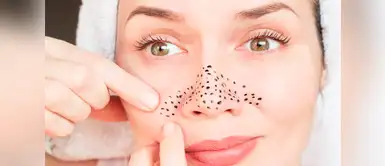 Sigue estos tips para eliminar los puntos negros Cinco tips para eliminar los puntos negros de la nariz