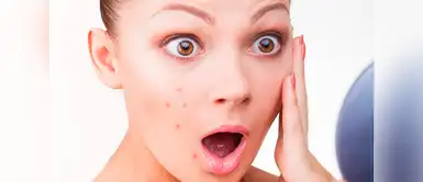 Solo debes realizar estas tres cosas todos los días. Tres cosas que debes hacer todos los días para evitar los granitos, según especialista