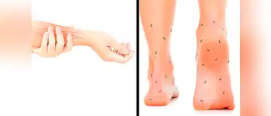 Los siguientes tips te ayudarán a combatir el hormigueo de las piernas Todo lo que debes saber del hormigueo en las manos y piernas