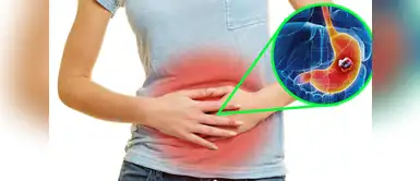 ¡No dejes de seguir estos consejos y así prevenir el cáncer al estómago! Helicobacter: ¿Cómo evitarla para disminuir el riesgo de desarrollar cáncer al estómago?