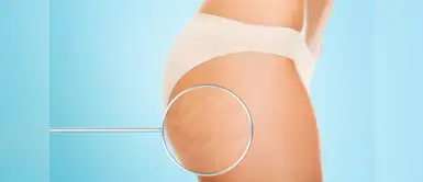 El chocolate te ayudará a desaparecer la celulitis Con esta receta de chocolate podrás eliminar la celulitis