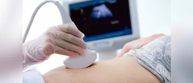 ¡Sigue estos consejos y lleva un embarazo sin preocupación alguna! Foto: Difusión) Ecografías durante el embarazo: ¿Cuál es la importancia y qué identifica cada una?