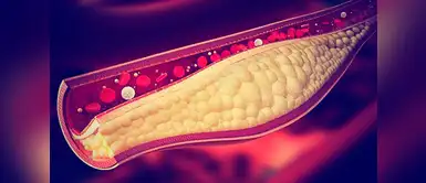 Dieta: cómo bajar los triglicéridos de forma rápida y natural. (Foto: Redes Sociales) Este régimen alimenticio te ayudará a controlar los triglicéridos naturalmente