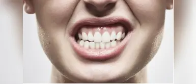 Vida saludable: qué es el bruxismo y cómo se trata. (Foto: Redes Sociales) Esta es la razón por la que rechinas los dientes al dormir