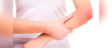 Vida saludable: ¿qué enfermedad causa moretones en el cuerpo? (Foto: Redes Sociales) ¿Te suelen aparecer moretones? Puede que sufras una de estas enfermedades