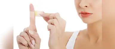 ¿Qué es bueno para las quemaduras? (Foto: Redes Sociales) Siete remedios caseros para aliviar las quemaduras en los dedos