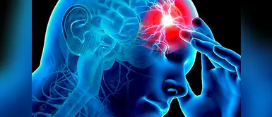 Ictus (Foto: Redes Sociales) 7 hábitos que te pueden ayudar a prevenir el ictus cerebral