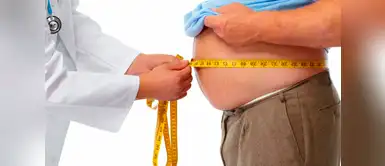 Obesidad (Foto: Redes Sociales) ¿La obesidad y el sobrepeso elevan el riesgo de sufrir fracturas en los adultos mayores?