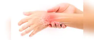 Estos ejercicios te ayudarán a mejorar las articulaciones de las manos afectadas por la artritis. (Foto: Redes Sociales) 5 fabulosos ejercicios de mano para combatir el dolor de la artritis