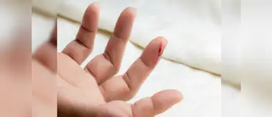 ¿Por qué cuando nos cortamos con papel nos duele tanto? ¿Por qué cuando nos cortamos con papel nos duele tanto?